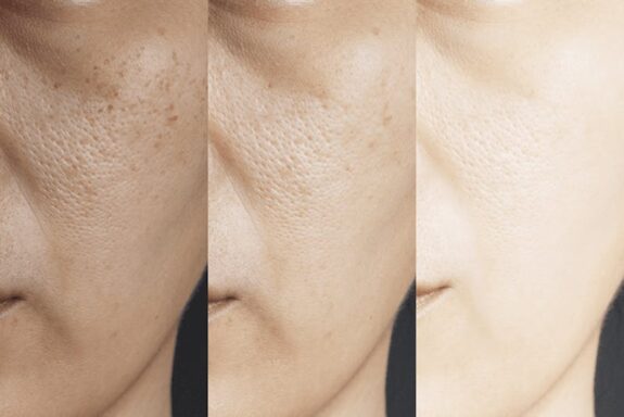 Hydroquinone & Retinol skincare product.