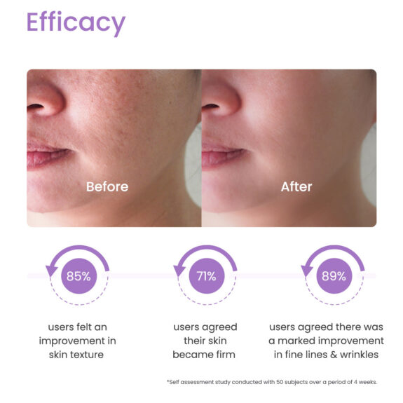 Retin-A cream for skin rejuvenation and acne treatment.