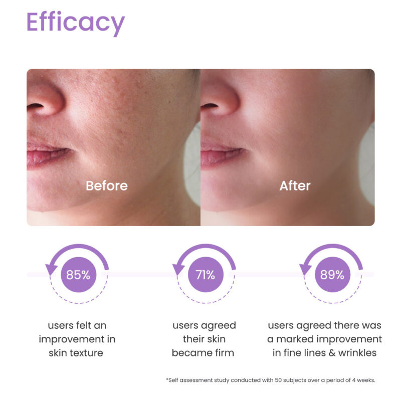 Retin-A cream for skin rejuvenation and acne treatment.