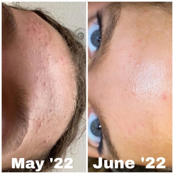 Cerave Renewing Retinol Serum with Tretinoin