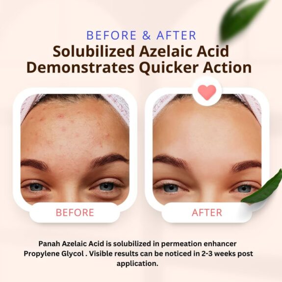 Niacinamide & Azelaic Acid Cream jar