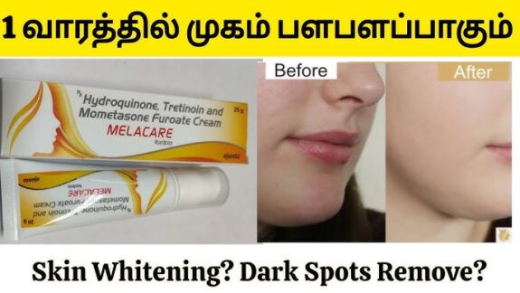 Hydroquinone, Tretinoin, Mometasone Furoate cream (Tamil label)